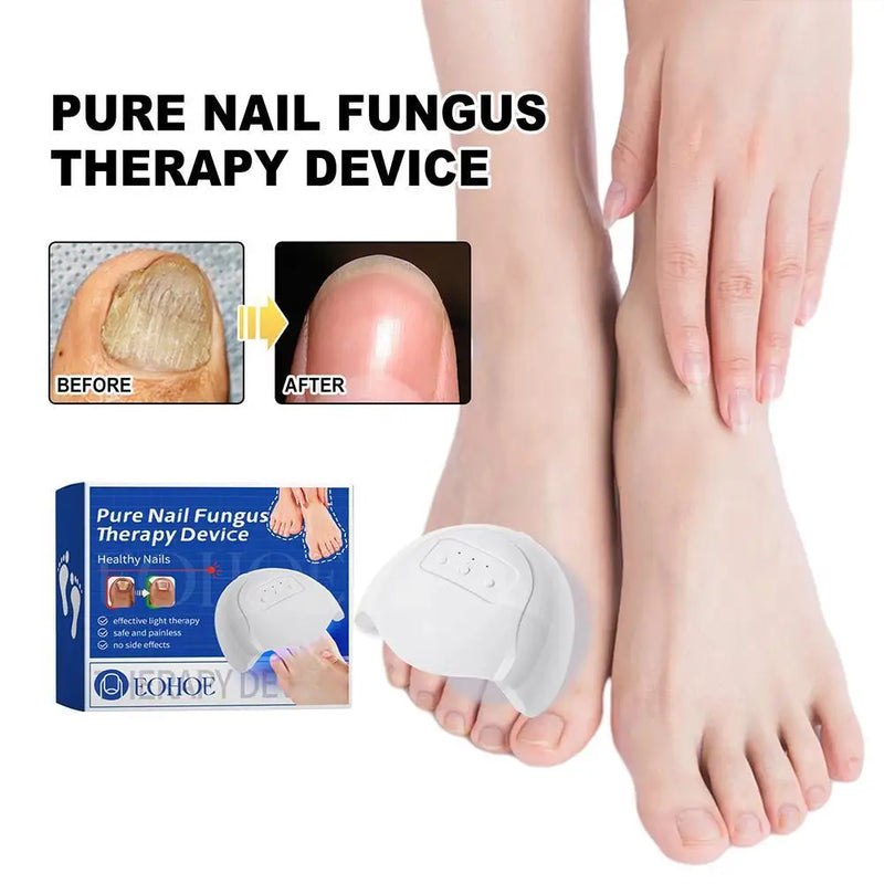 Mroix™ Pure Nail | Svamp i Neglene Laser Apparat