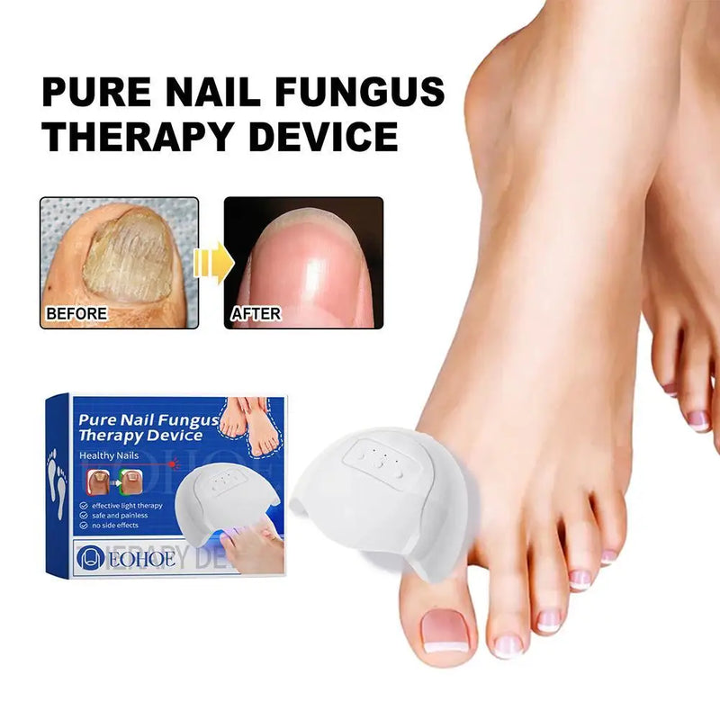 Mroix™ Pure Nail | Svamp i Neglene Laser Apparat